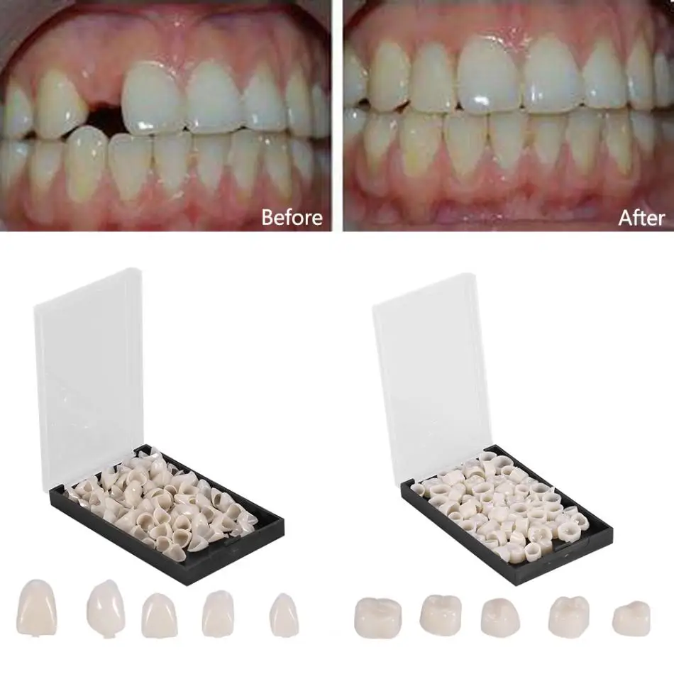 

50Pcs/Box Dental Crowns Resin Porcelain Materials Temporary Teeth Crown Realistic Oral Care Teeth Whitening Anterior Molar Crown