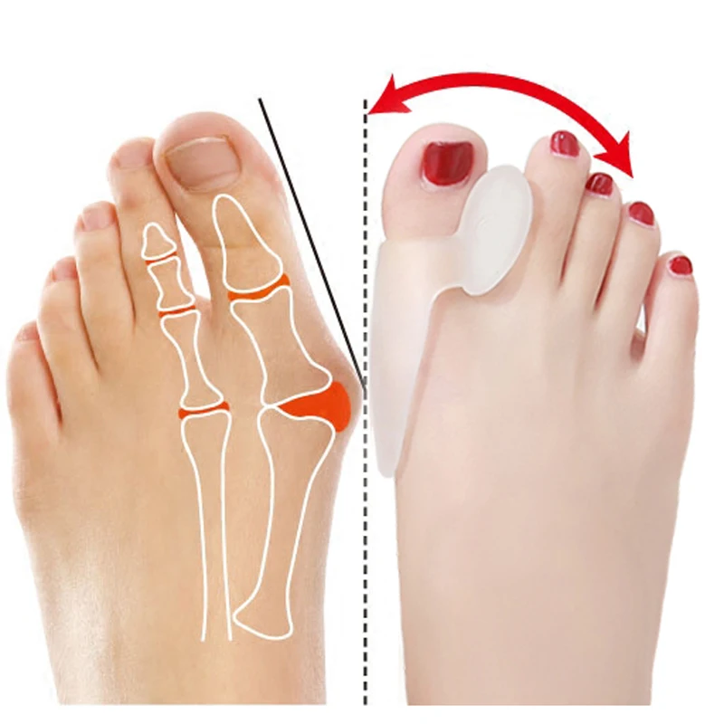 2 пары разделитель для ног для пальцев ортопедическая вальгусная коррекция вальгусной деформации педикюр силиконовая шина для пальцев кость пальца ноги коррекция положения большого пальца