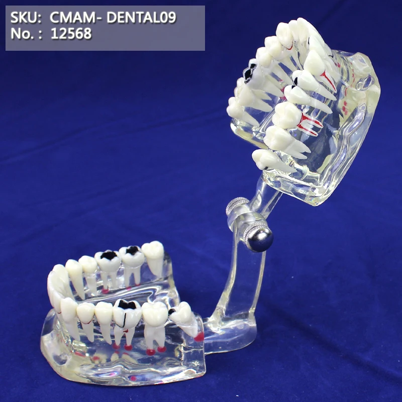 T CMAM/12568 Dental-patological Стоматологическая модель, demo, Human Oral Dental медицинское обучение анатомическая модель