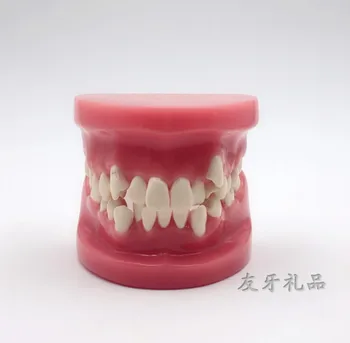 

Dental correction model orthodontic practice model oral Viscosity orthodontic model