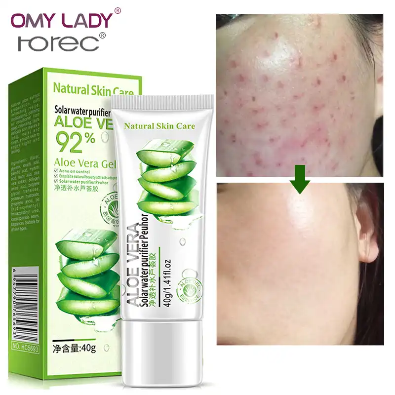 aloe vera cream for face at home