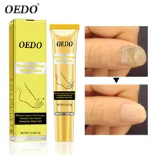 1 шт. травяной крем для ног противогрибковые крем для ремонта ног снимает крем Beriberi Уход за ногами Лечение Уход за кожей противогрибковые инфекции