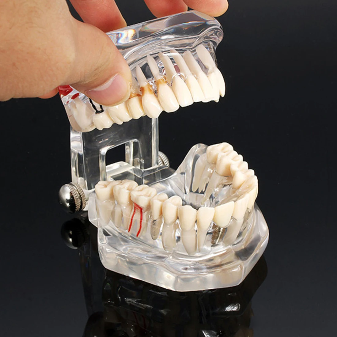 

Good Dental Implant Disease Teeth Model With Restoration Bridge Malocclusion Orthodontic Model For Medical Science Dental