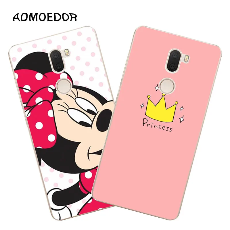 

xiaomi mi5 mi 5s plus Case,Silicon Cartoon Animal Painting Soft TPU Back Cover for xiaomi mi 5 mi5s plus Phone fitted case