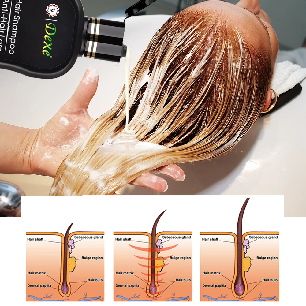 مكافحة فقدان الشعر الشامبو المهنية الصينية العشبية النمو علاج الشعر الشعر منع سميكة منتجات العناية بالشعر للكبار 200 مللي