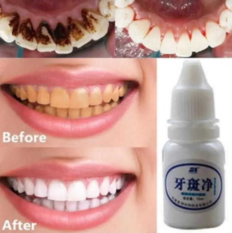 10 мл стоматологический инструмент для отбеливания зубов, стоматология; стоматологический odontogia Dentista уход за зубами, водный для рта, гигиеническая чистка зубов