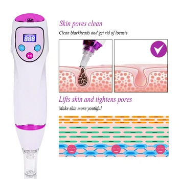 

Blackhead Vacuum Cleaner Face Pore Acne Pimple Remover Skin Care Beauty Device Facial Diamond Dermabrasion Clean Massage Tools