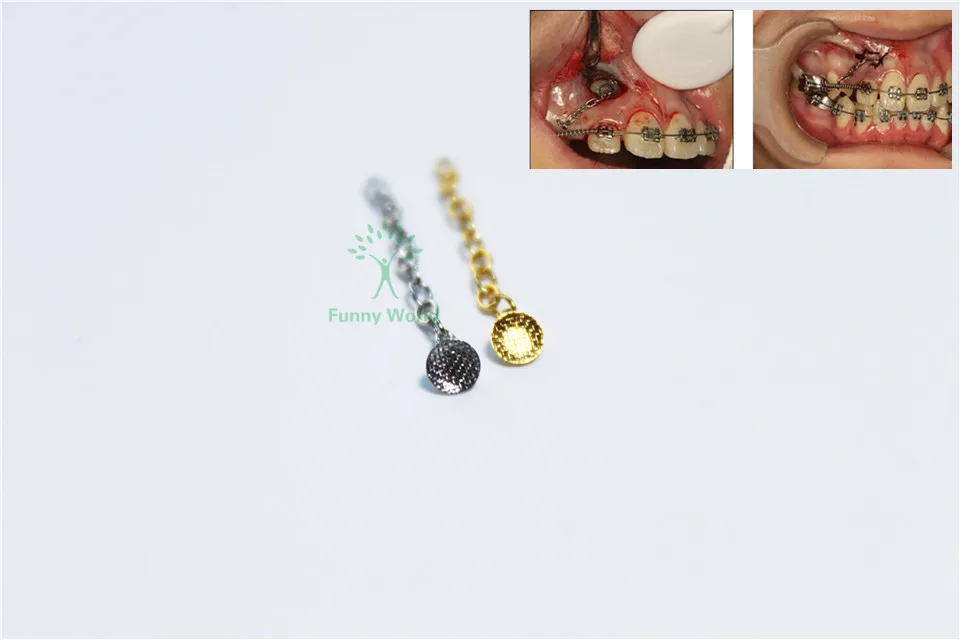 Sale 4Pcs Dental Group Orthodontic Button Chain Silver Lingual Traction
