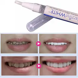 Профессиональный белый зуб для отбеливания зубов профессиональный набор для отбеливания Зубов Гелевая Ручка #20,15