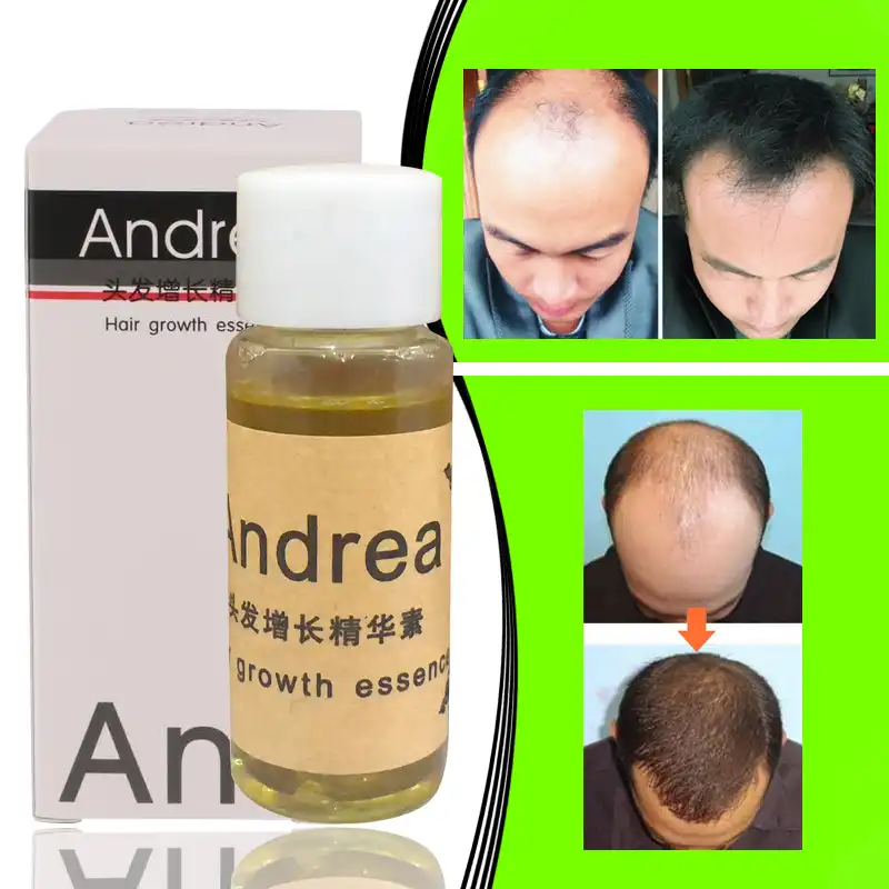 1pcs Andrea Hair Growth Essence Anti Hair Loss Product Shampoo