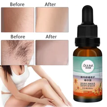 Гиалуроновая кислота для удаления волос ремонт жидкий экстракт Сыворотка для тела ингибитор роста волос для депиляции лица ног тела подмышек TSLM2