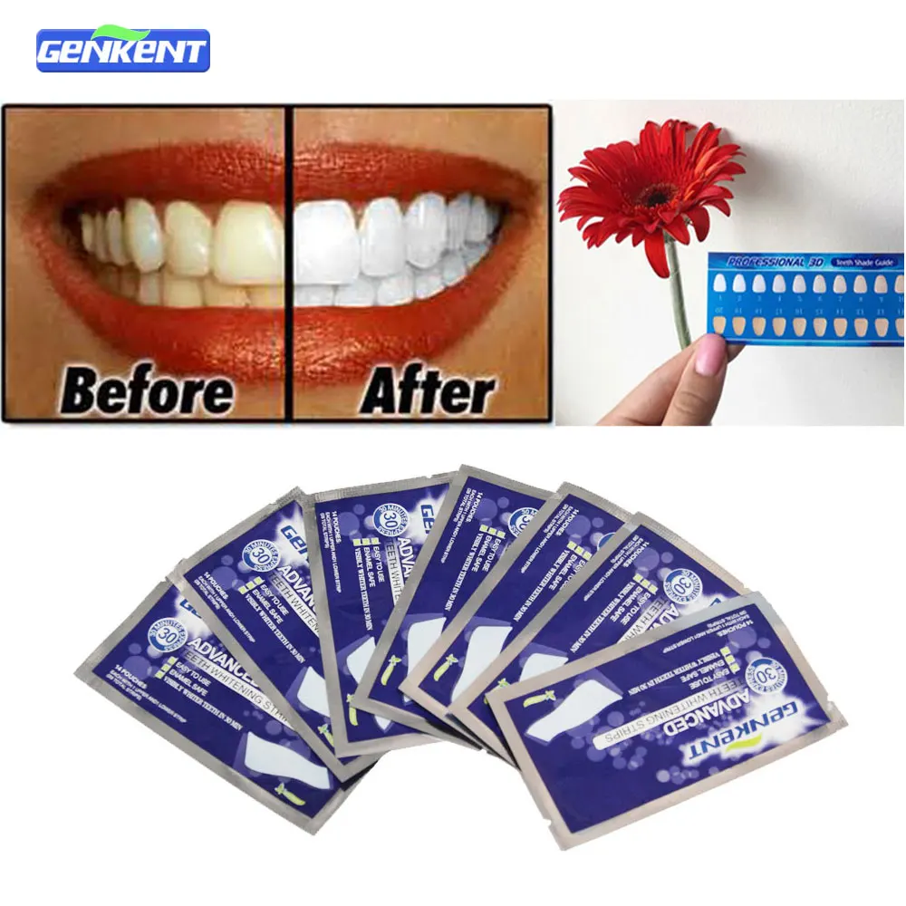 Whitening strips coupons ★ Crest Whitening Toothpaste With Scope Whitening Strips For Teeth Zoom Teeth Whitening Rockville Crest Whitening Toothpaste With Scope Teeth Whitening Quotes Teeth Whitening Baking Soda And Peroxide Whitening Strips For Teeth For professional individuals, making a name in the certain field is very difficult.