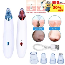 Алмазная дермабразия угрей пылесос всасывание удаление шрамов акне пилинг для пор лица чистый уход за кожей лица