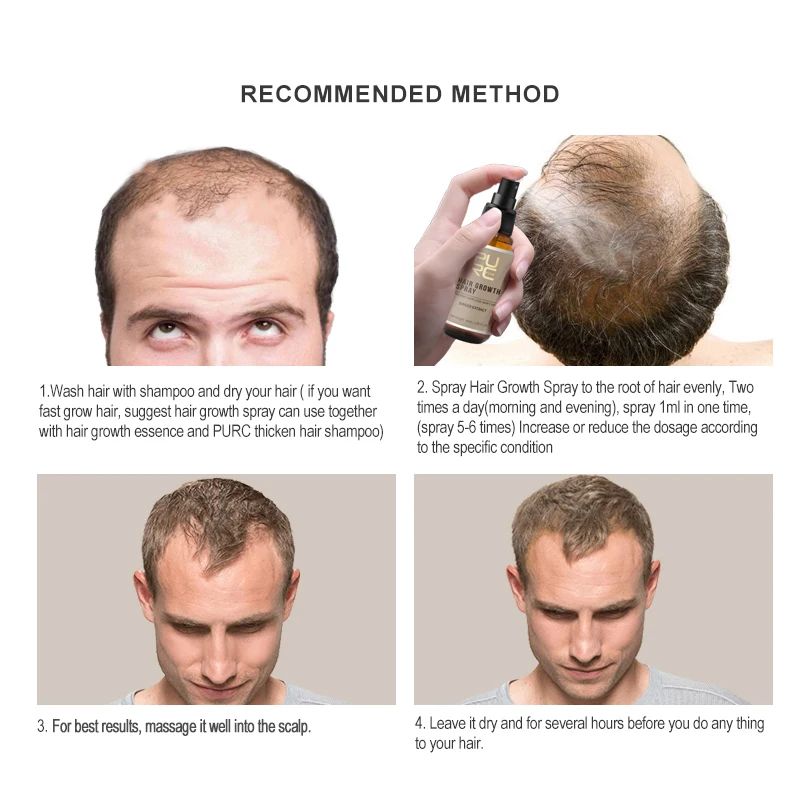 Miracle Hair Growth Spray Ginger Extract Prevent Hair Loss