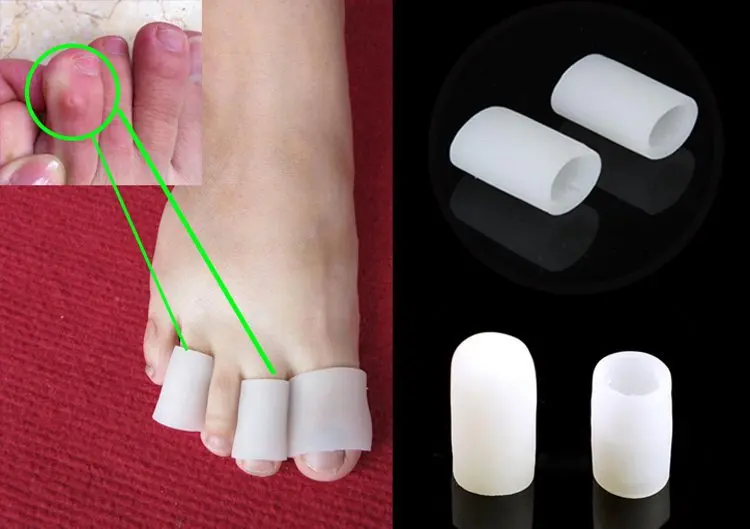 

Delicate Hot Sales Gel Toe protector & Toe Separators silicone gel Tube to cushion corns and calluses for feet care