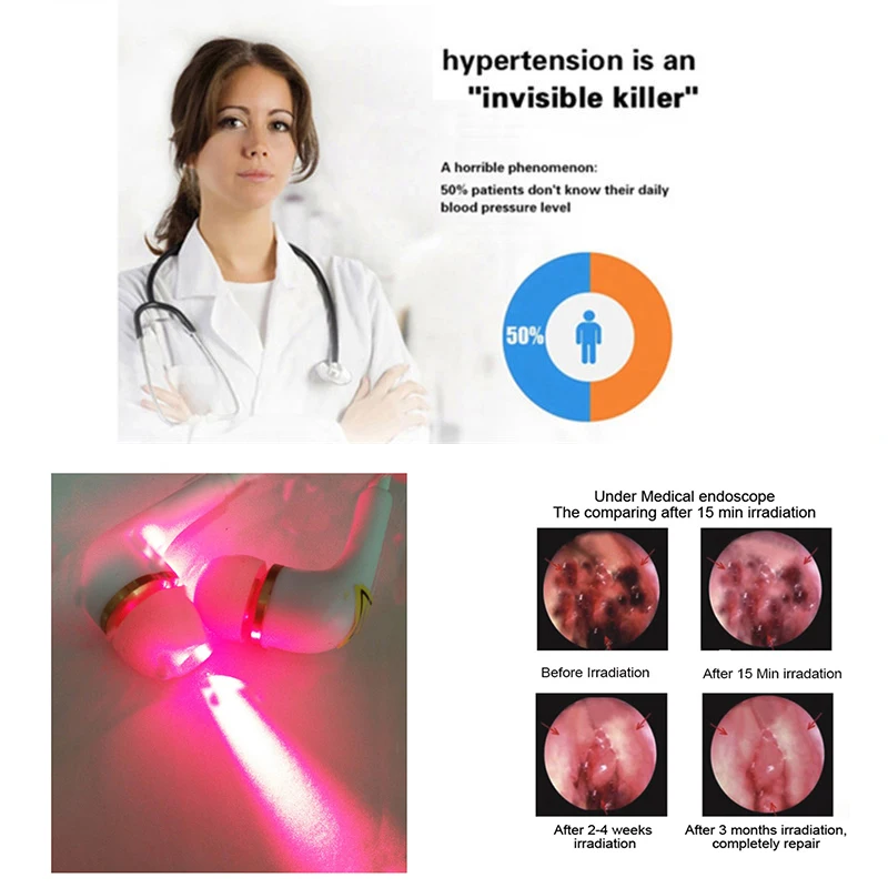 

Tinnitus Cerebrovascular Disease Otitis Media Physical infrared Device DR. Laser Therapeutic Acupuncture Laser Watch Clean Blood