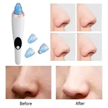 Электрический прибор для вакуумной чистки угрей машинка для удаления лицо поры очиститель инструмент красоты