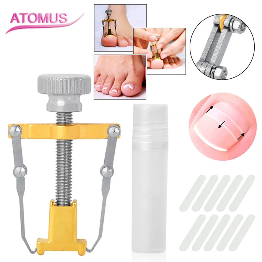 ATOMUS 1 шт. инструмент для коррекции вросших пальцев ног из нержавеющей стали+ 10 шт. инструмент для коррекции ногтей