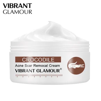 

Crocodile Remove Stretch Marks Cream Anti Wrinkle Aging Maternity Skin Repair Remove Pregnancy Scars Treatment Body Skin Care