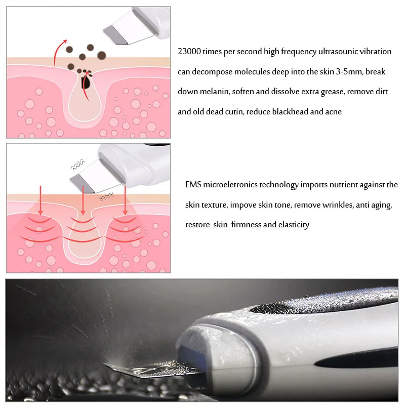 Ультразвуковая Гальваническая ионная EMS, лифтинг, скруббер, пилинг, очиститель пор, очищающее средство для лица, набор для отбеливания лица, система отшелушивания