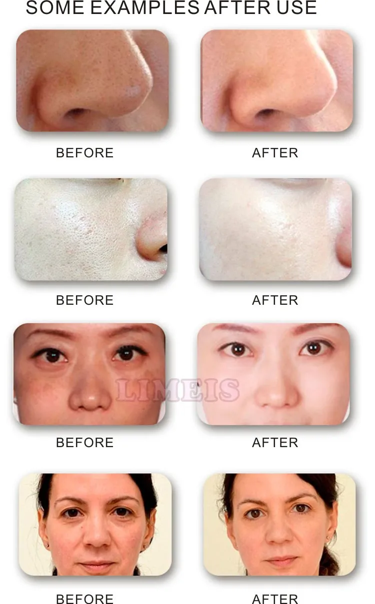 PDT led photon facial mask