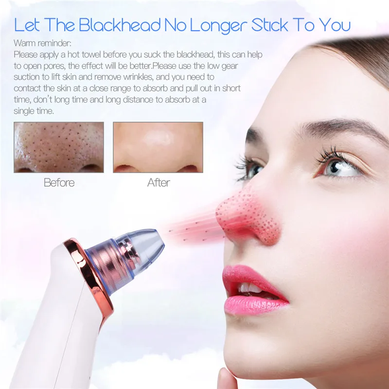 

CkeyiN Skin Care Tools Blackhead Remover Vacuum Suction Face Pimple Acne Comedone Extractor Facial Pores Cleaner