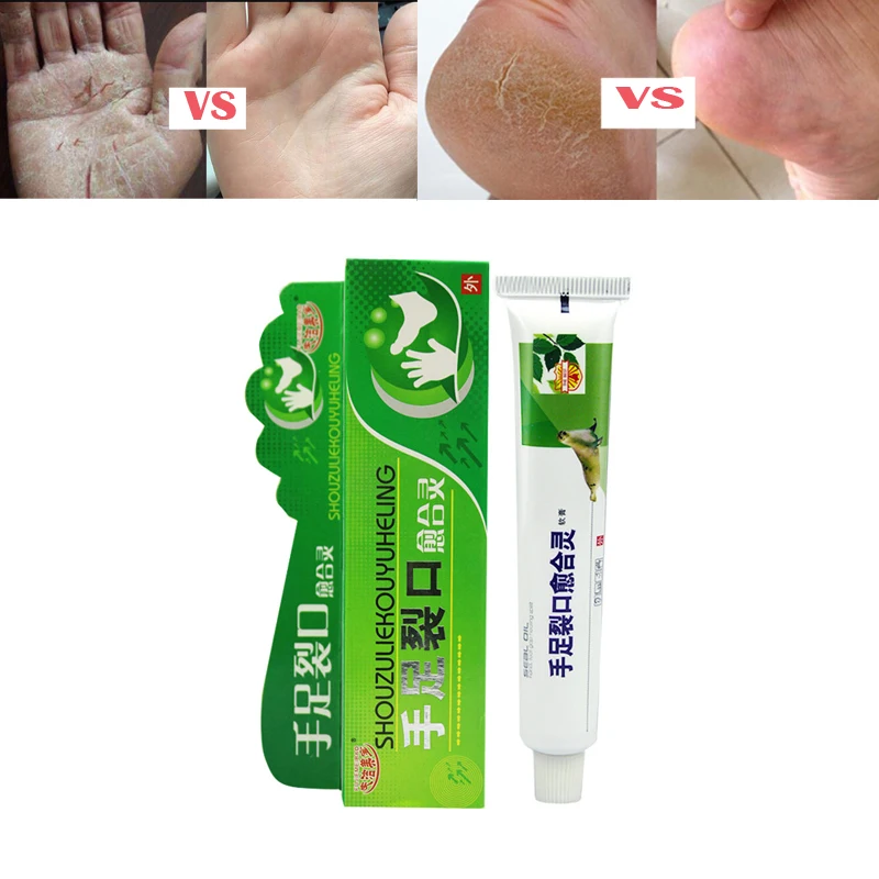 Powerful Chinese Ointment Cream Hand Foot Crack Cream Heel Chapped Peeling Foot and hand Repair Anti Dry Crack skin care