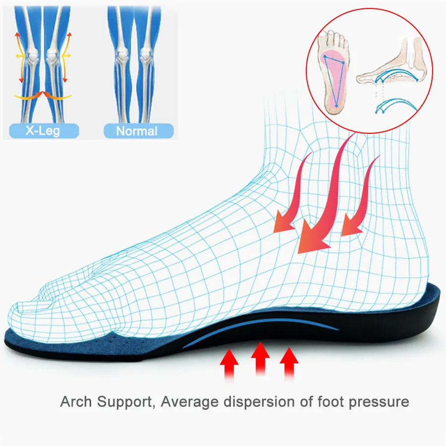 Ортопедические стельки от плоскостопия ортопедические стельки для поддержки стопы стельки для обуви Varus подушечки для ног ортопедические подушечки для ухода за кожей plantillas para los