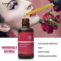 100%Original NewZealand Trilogy Certified Organic Rosehip Oil for Scars Fine Lines Wrinkles Stretch Marks Dehydrated Ageing Skin 100%Original NewZealand Trilogy Certified Organic Rosehip Oil for Scars Fine Lines Wrinkles Stretch Marks Dehydrated Ageing Skin