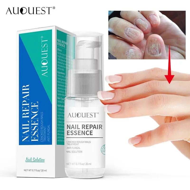 Buy New AuQuest Nail Repair Essence Cracked Rough Nail Treatment Anti Fungal