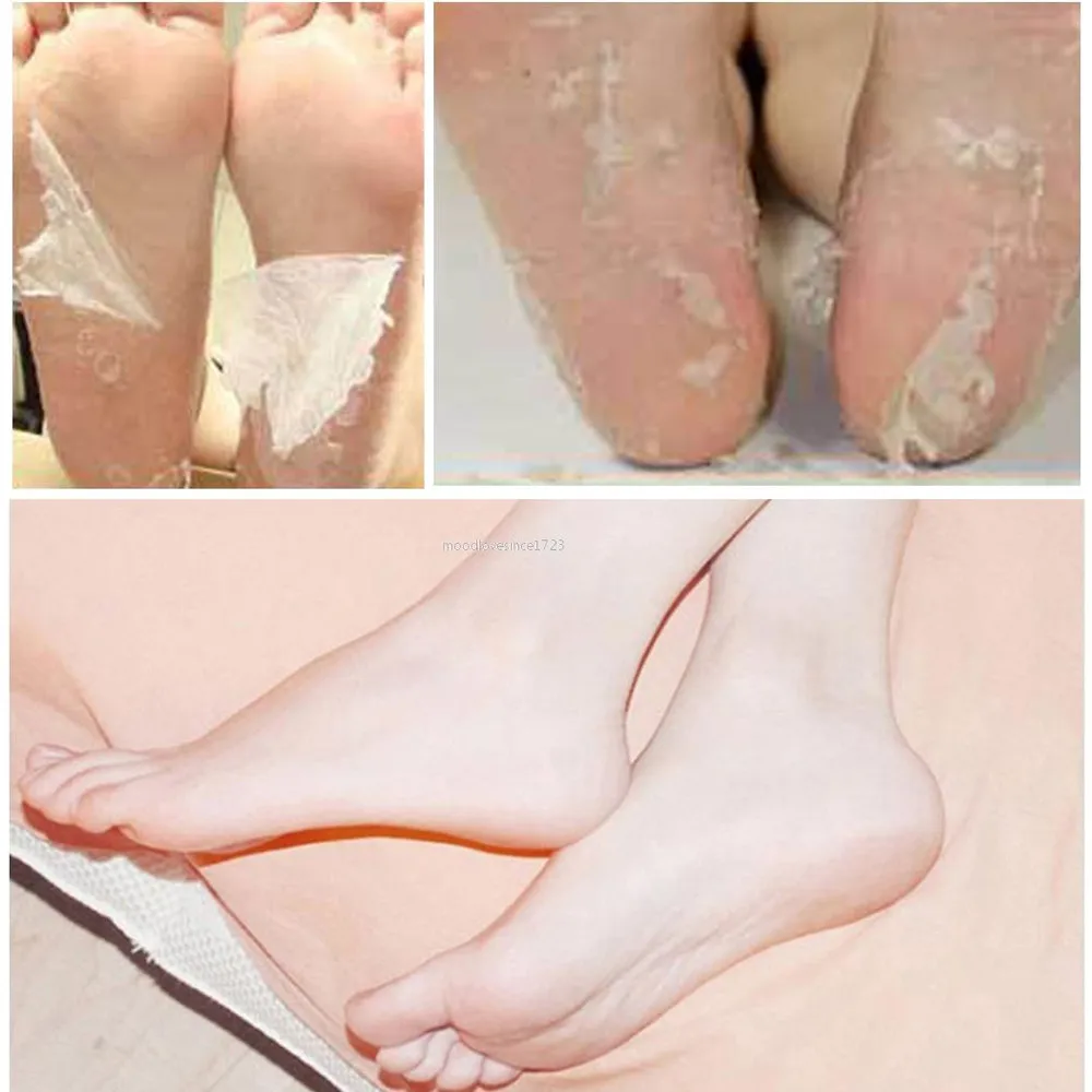 

1 Pack Foot Mask Peeling Foot Care Renewal Foot Mask Remove Dead Skin Cuticles Heel Socks For Pedicure Exfoliating Foot Mask #35