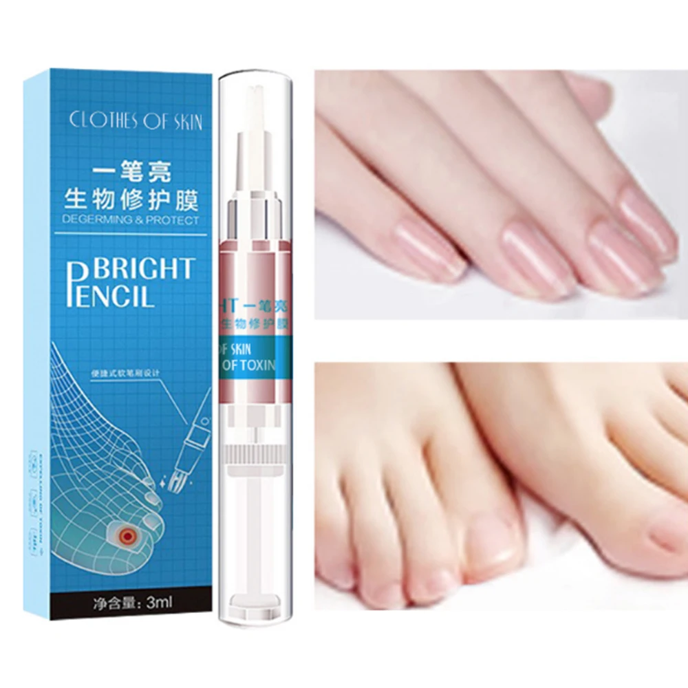 

1Pcs Nail Fungal Treatment Pen Anti Fungus Infection Biological Repair Solution Nutritious Oil 3ml Restores Healthy Plaster D034