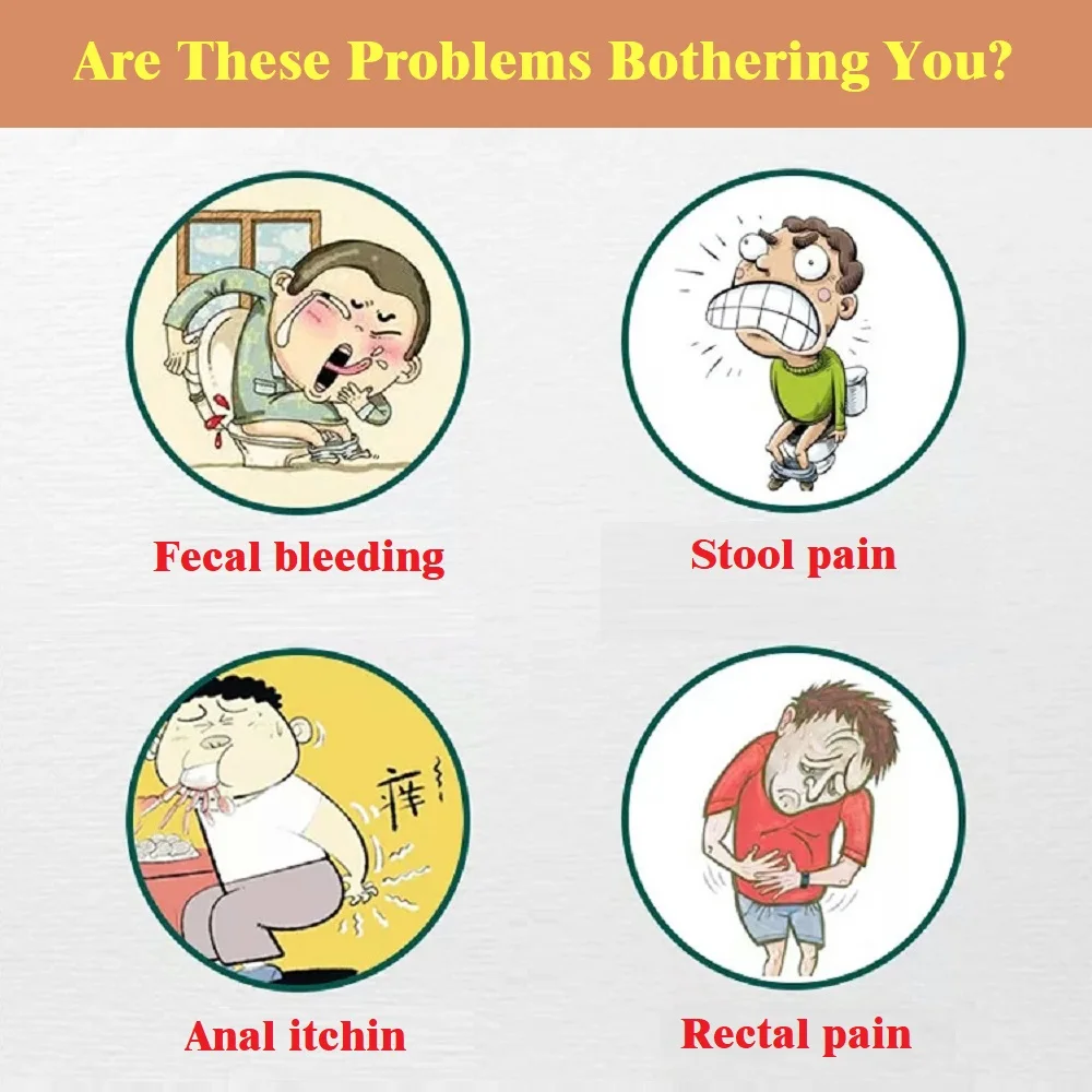 5 шт./лот, мазь от геморроя Hua Tuo, Китайский крем, обезболивающий, облегчающий боль, внешний анальный размытый медицинский пластырь