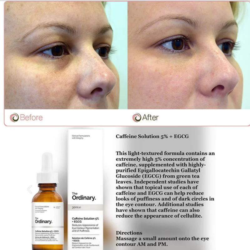 

The Ordinary 5% Caffenie + EGCG Eye Serum Eliminate Best Eye Cream For Wrinkles Dark Circle Puffiness
