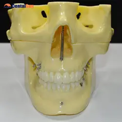 Ортодонтическая модель зубов имплантата для демонстрации M2016