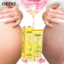 Роза удаляет крем от растяжек анти против морщин и старения ремонт кожи материнства удалить беременность шрамы уход за кожей тела