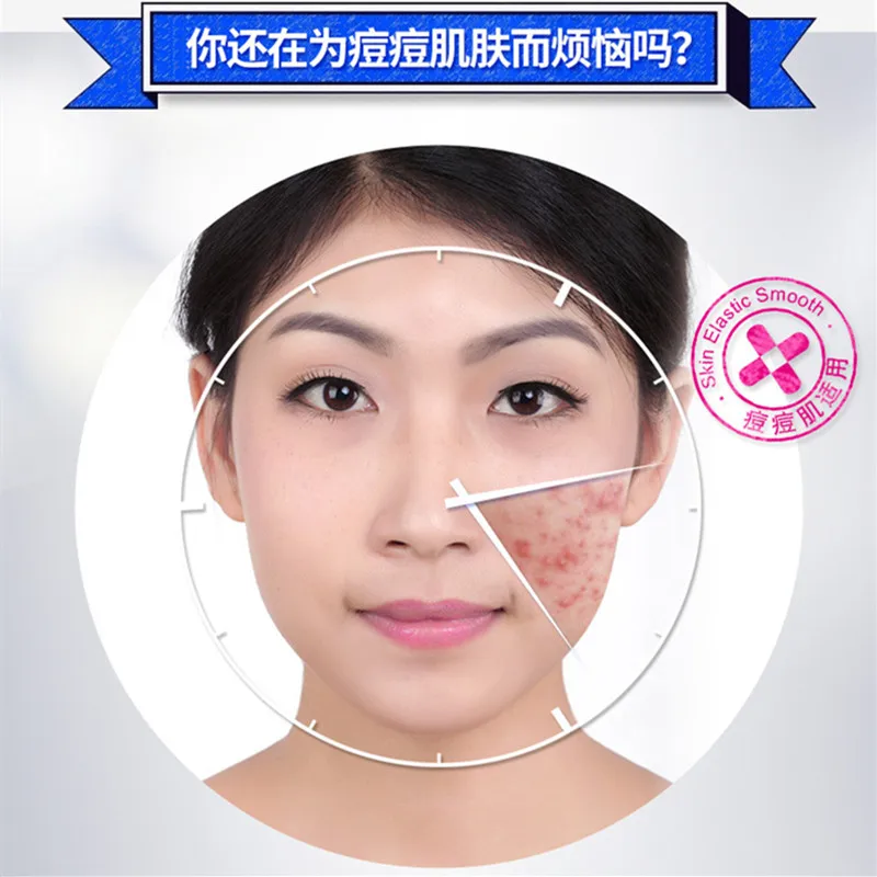 BIOAQUA 1PC Anti Acne Treatment Cream Whitening Skin Care  Oil Control Moisturizing Acne Scar Remover Pores Acne Cream 2
