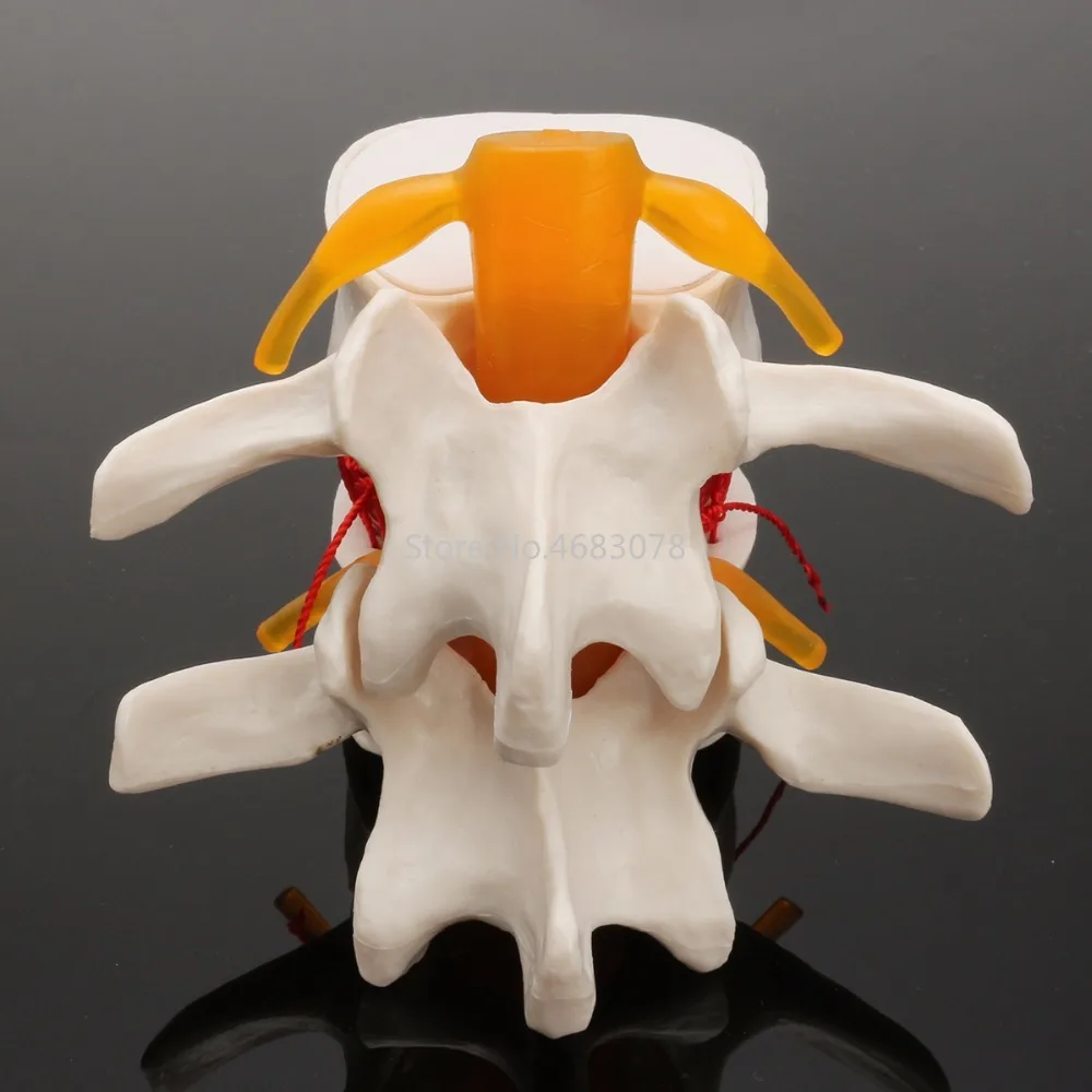 Goedkoop Dental 11 Menselijk anatomie skelet Wervelkolom Lumbale Hernia Onderwijs Model