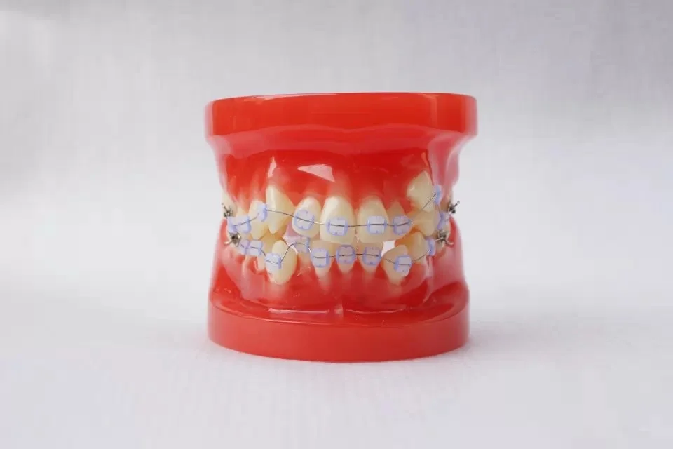 B4-03 Ortho Ceramic Bracket