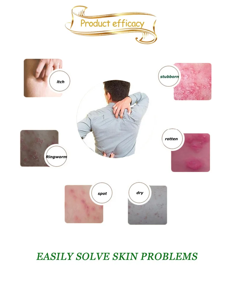 Без коробки!) QINGWANPI китайские кремы для тела Уход за кожей кремы исключительно для проблем с кожей крем 15 г