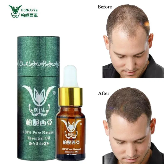 Hair Growth Essence Professional Salon Hairstyles Keratin Hair Care Styling Products Anti Hair