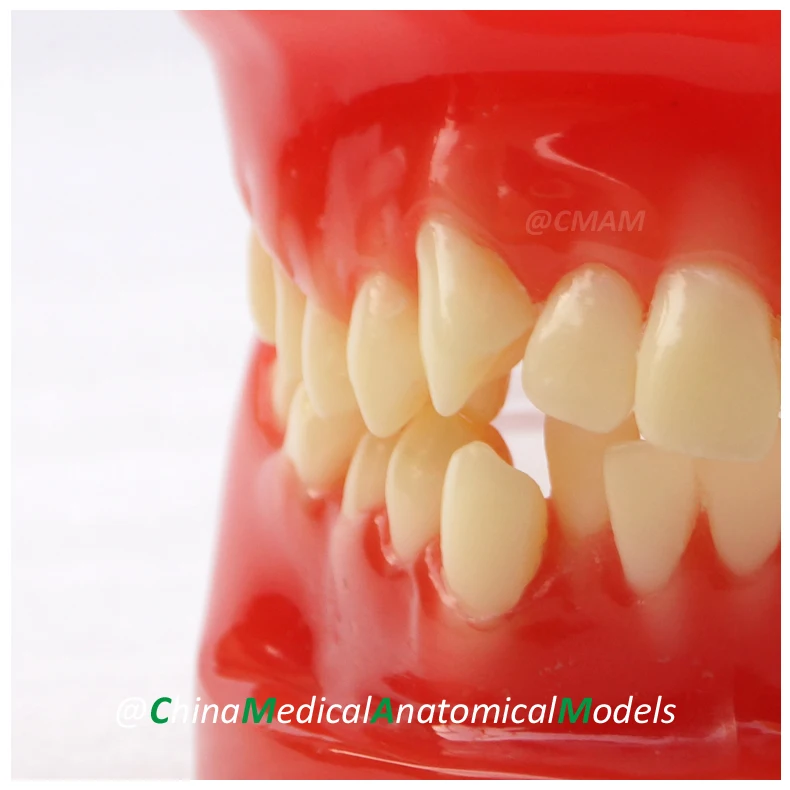 № 13030, Ортодонтическая модель, стоматолог обучение полости рта стоматологический ортодонтический модель, Китай медицинский анатомический