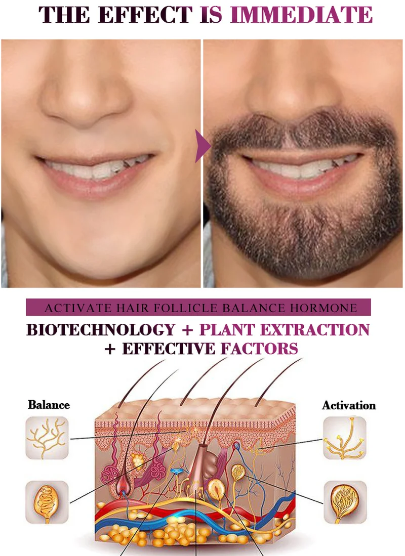 Профессиональный Усилитель роста бороды для мужчин искусственный рост усов