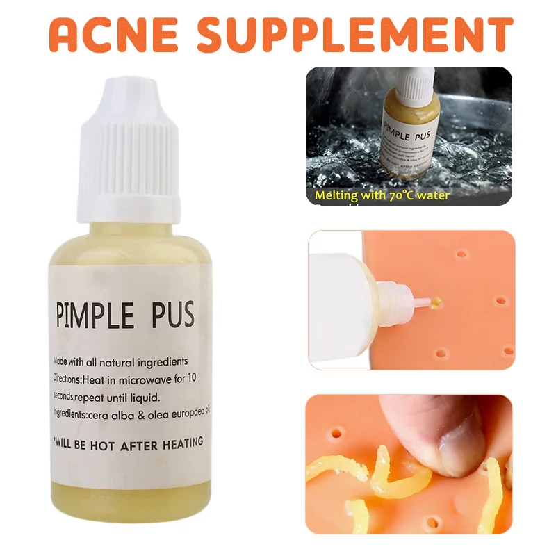 

Squeezing Acne Liquid Additive Toys Replenisher Stop Picking Your Face Gags Pressure-Releasing Stress Reliever Toys Frank