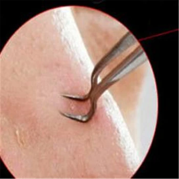 

1Pc Stainless Steel Acne Needle Tweezers Blackhead Remover Extrator Face Care Tool