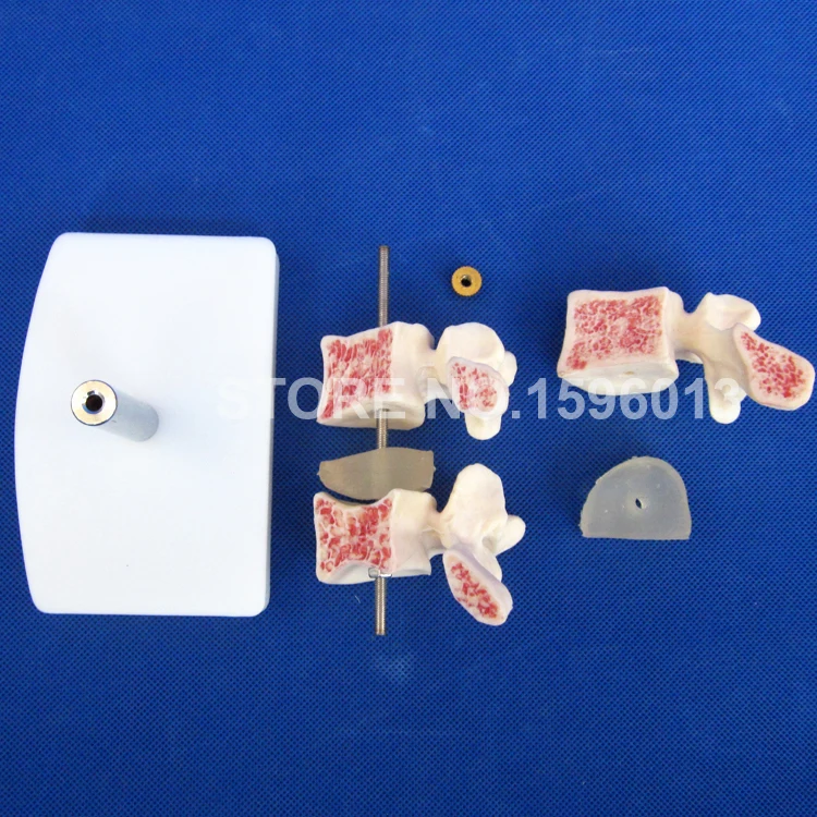 134 osteoporosis model (6)
