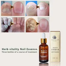 Health Skin Care Herbal Nail Repair Treatment Essential Oil Onychomycosis Remover Serum Beauty Disinfect LY4