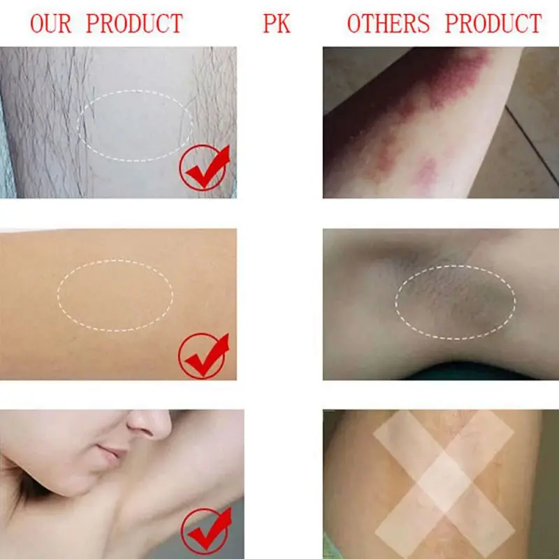 Jual 60G Rambut Removal Cream untuk Boby Leg Rambut Kemaluan Ketiak Pudendal Depilatory Tempel