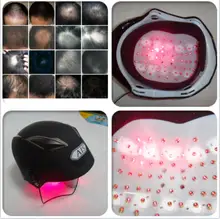 laser scalp massager LLL therapy anti hair loss problem product for sale 64 diodes