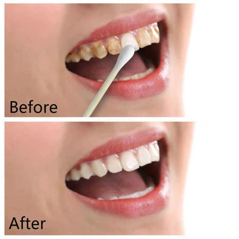 Инструменты для отбеливания зубов Чистка рта жидкое отбеливание зубов набор здоровое удаление чая пятнистый пигмент зубного налета кофе